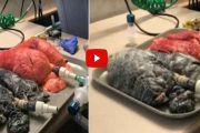 Vidéo: Voici la différence entre des poumons sains et ceux d’une personne qui fume un paquet par jour